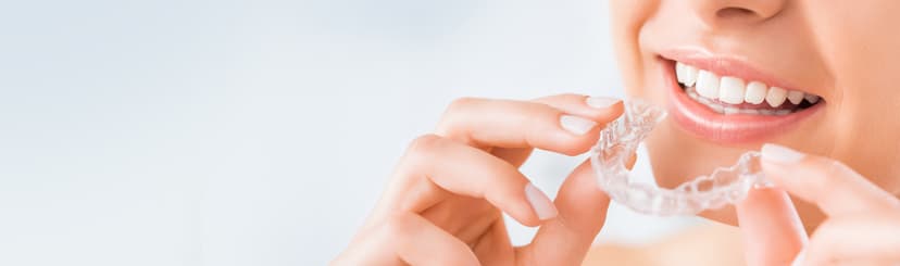 Aligners